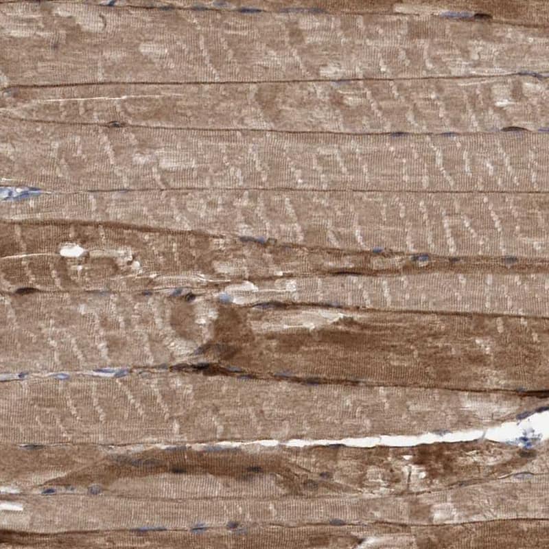 COBL Antibody - BSA Free Immunohistochemistry-Paraffin: COBL Antibody - BSA Free [NBP1-89615]