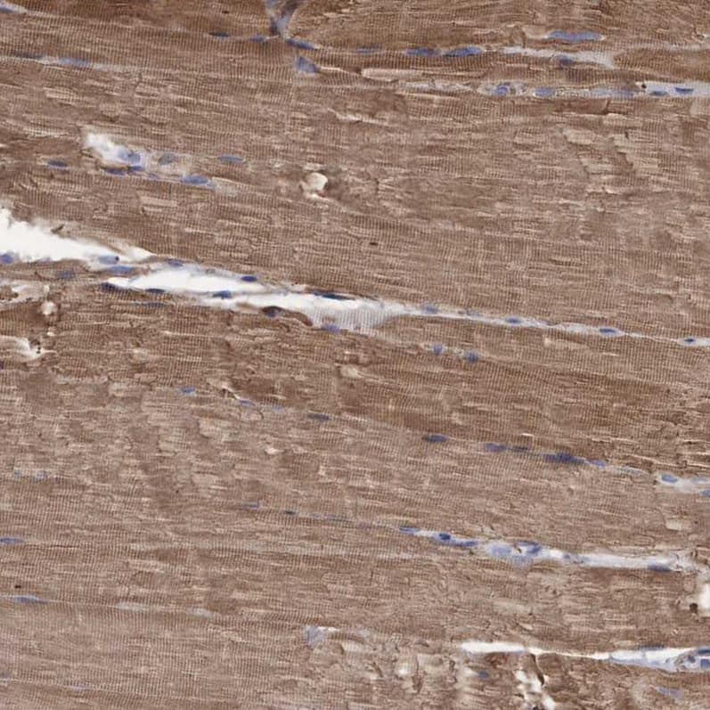 COBL Antibody - BSA Free Immunohistochemistry-Paraffin: COBL Antibody - BSA Free [NBP1-89616]