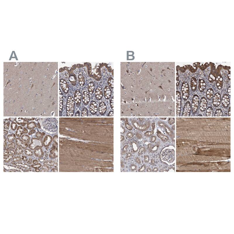 COBL Antibody - BSA Free Immunohistochemistry-Paraffin: COBL Antibody - BSA Free [NBP1-89616]