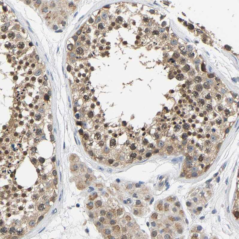 LARG Antibody - BSA Free Immunohistochemistry-Paraffin: LARG Antibody - BSA Free [NBP1-89619]
