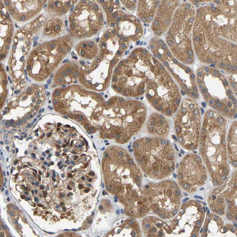 LARG Antibody - BSA Free Immunohistochemistry-Paraffin: LARG Antibody - BSA Free [NBP1-89619]