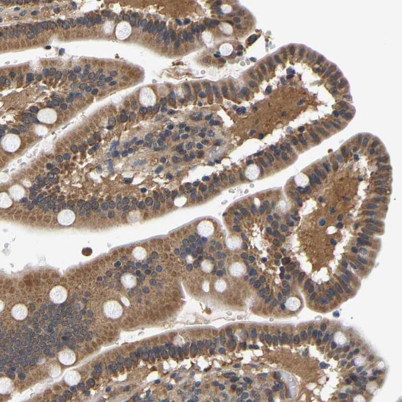 LARG Antibody - BSA Free Immunohistochemistry-Paraffin: LARG Antibody - BSA Free [NBP1-89619]
