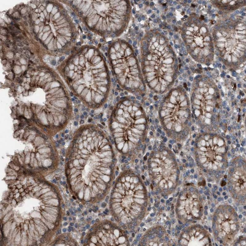 Plexin B2 Antibody - BSA Free Immunohistochemistry-Paraffin: Plexin B2 Antibody - BSA Free [NBP1-89620]