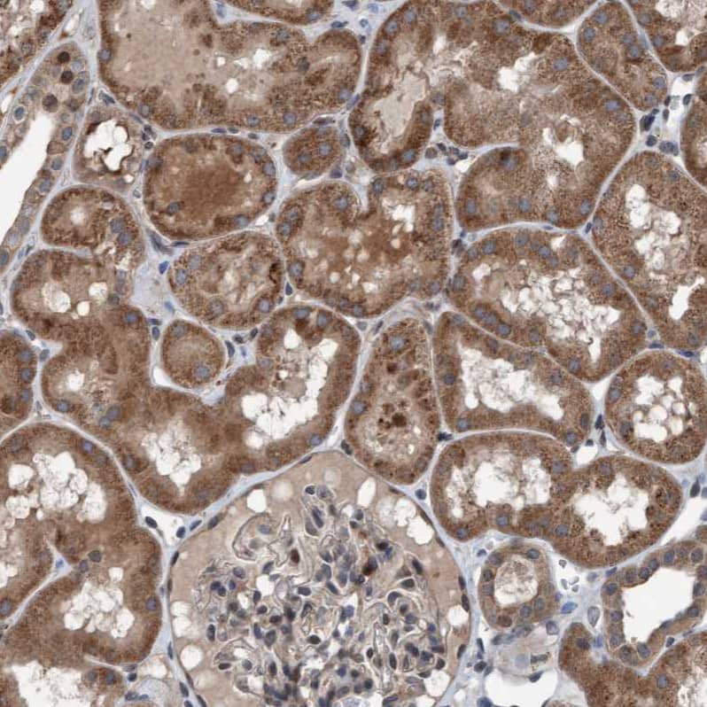 Plexin B2 Antibody - BSA Free Immunohistochemistry-Paraffin: Plexin B2 Antibody - BSA Free [NBP1-89620]