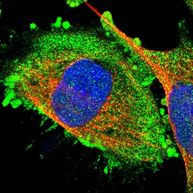 RGP1 Antibody - BSA Free Immunocytochemistry/ Immunofluorescence: RGP1 Antibody [NBP1-89621]