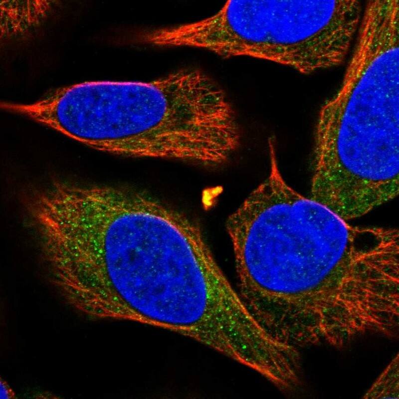 RGP1 Antibody - BSA Free Immunocytochemistry/ Immunofluorescence: RGP1 Antibody [NBP1-89622]