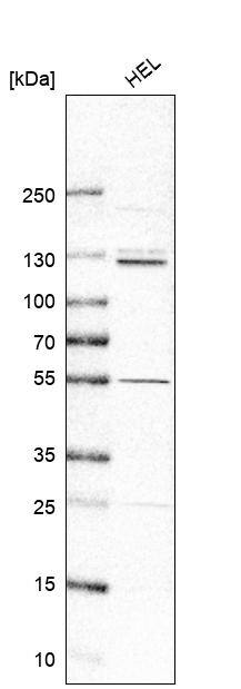 PUM2 Antibody - BSA Free Western Blot: PUM2 Antibody - BSA Free [NBP1-89623]