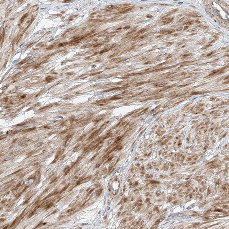 PUM2 Antibody - BSA Free Immunohistochemistry-Paraffin: PUM2 Antibody - BSA Free [NBP1-89623]