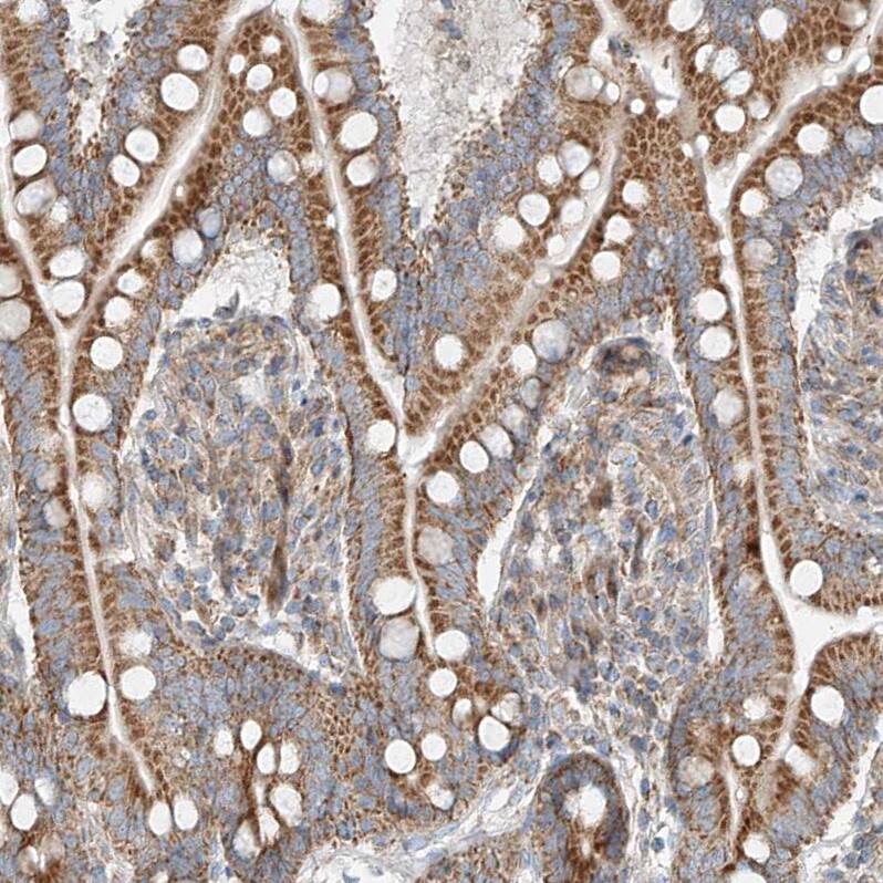 PUM2 Antibody - BSA Free Immunohistochemistry-Paraffin: PUM2 Antibody - BSA Free [NBP1-89623]