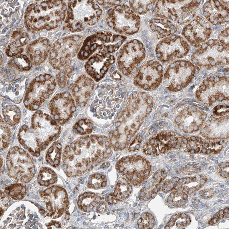 PUM2 Antibody - BSA Free Immunohistochemistry-Paraffin: PUM2 Antibody - BSA Free [NBP1-89623]