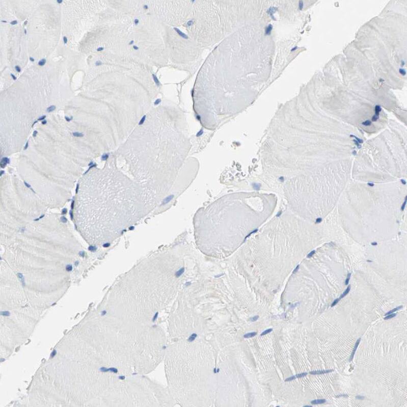 Septin-6 Antibody - BSA Free Immunohistochemistry-Paraffin: Septin-6 Antibody - BSA Free [NBP1-89626]