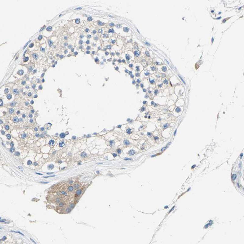 Septin-6 Antibody - BSA Free Immunohistochemistry-Paraffin: Septin-6 Antibody - BSA Free [NBP1-89626]