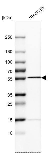 Septin-6 Antibody - BSA Free Western Blot: Septin-6 Antibody - BSA Free [NBP1-89626]