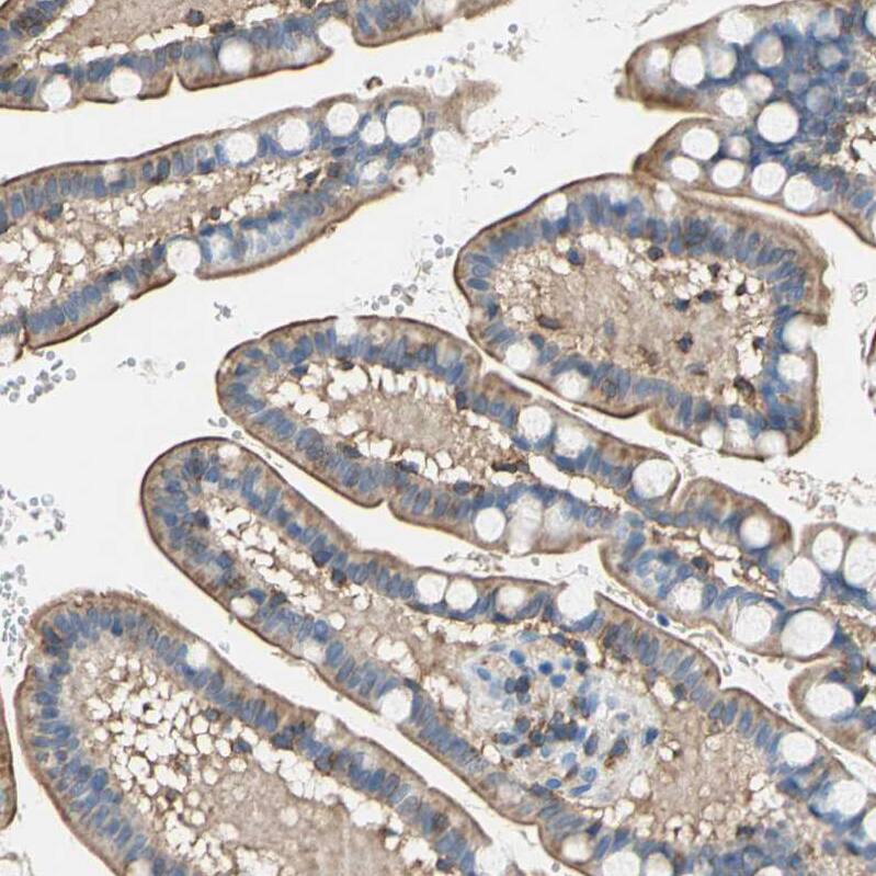 Septin-6 Antibody - BSA Free Immunohistochemistry-Paraffin: Septin-6 Antibody - BSA Free [NBP1-89626]