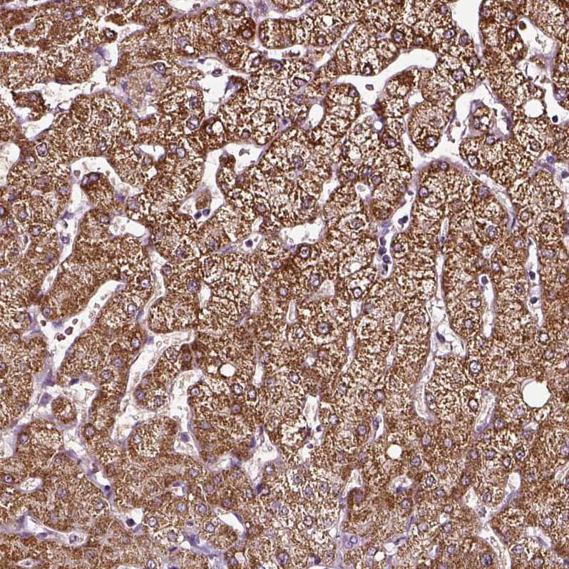 alpha-Aminoadipate Aminotransferase Antibody - BSA Free Immunohistochemistry-Paraffin: alpha-Aminoadipate Aminotransferase Antibody - BSA Free [NBP1-89627]