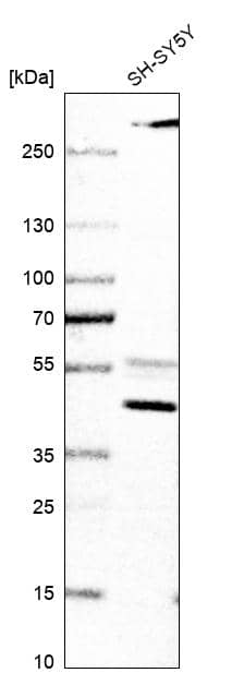 alpha-Aminoadipate Aminotransferase Antibody - BSA Free Western Blot: alpha-Aminoadipate Aminotransferase Antibody - BSA Free [NBP1-89627]