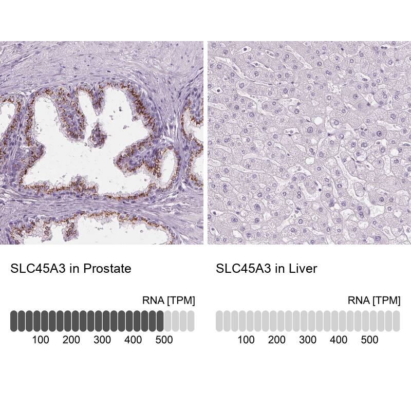 SLC45A3/Prostein Antibody - BSA Free Immunohistochemistry-Paraffin: SLC45A3/Prostein Antibody - BSA Free [NBP1-89629]
