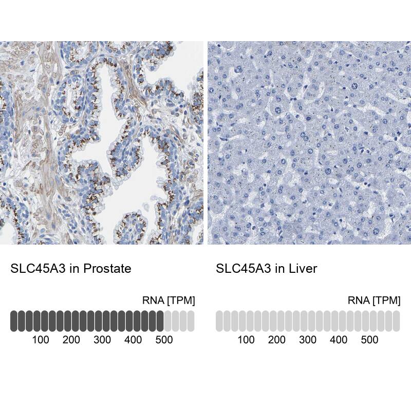 SLC45A3/Prostein Antibody - BSA Free Immunohistochemistry-Paraffin: SLC45A3/Prostein Antibody - BSA Free [NBP1-89630]