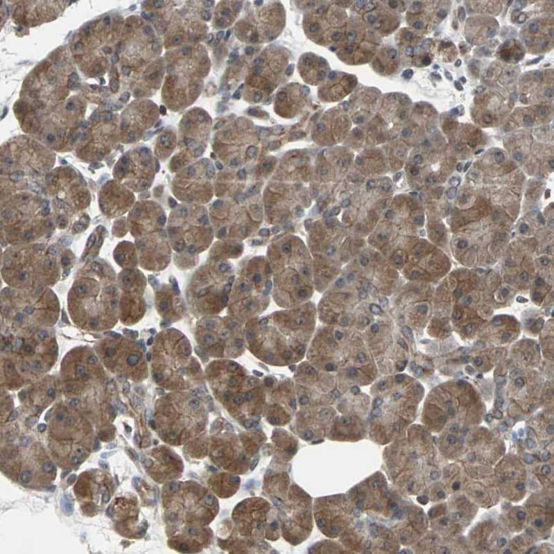 Lipolysis Stimulated Lipoprotein Receptor Antibody - BSA Free Immunohistochemistry-Paraffin: Lipolysis Stimulated Lipoprotein Receptor Antibody - BSA Free [NBP1-89631]