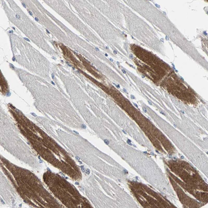 Lipolysis Stimulated Lipoprotein Receptor Antibody - BSA Free Immunohistochemistry-Paraffin: Lipolysis Stimulated Lipoprotein Receptor Antibody - BSA Free [NBP1-89631]