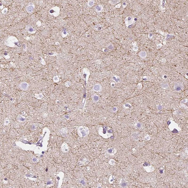 IGSF4C/SynCAM4 Antibody - BSA Free Immunohistochemistry-Paraffin: IGSF4C/SynCAM4 Antibody - BSA Free [NBP1-89636]