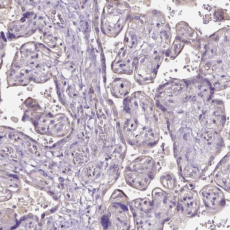 IGSF4C/SynCAM4 Antibody - BSA Free Immunohistochemistry-Paraffin: IGSF4C/SynCAM4 Antibody - BSA Free [NBP1-89636]