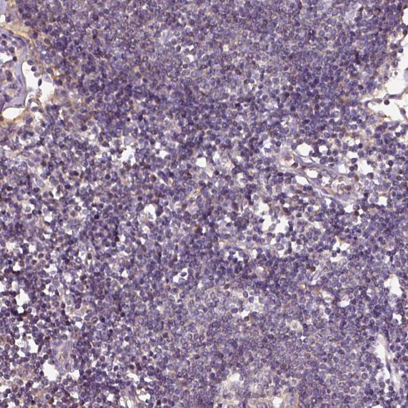 IGSF4C/SynCAM4 Antibody - BSA Free Immunohistochemistry-Paraffin: IGSF4C/SynCAM4 Antibody - BSA Free [NBP1-89636]
