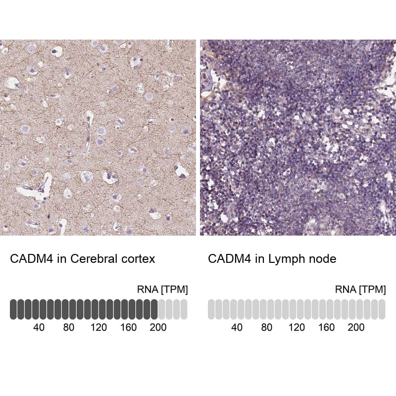IGSF4C/SynCAM4 Antibody - BSA Free Immunohistochemistry-Paraffin: IGSF4C/SynCAM4 Antibody - BSA Free [NBP1-89636]