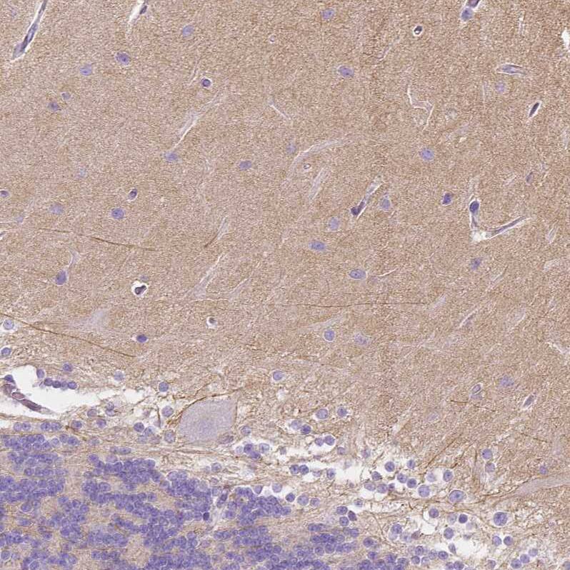 IGSF4C/SynCAM4 Antibody - BSA Free Immunohistochemistry-Paraffin: IGSF4C/SynCAM4 Antibody - BSA Free [NBP1-89636]