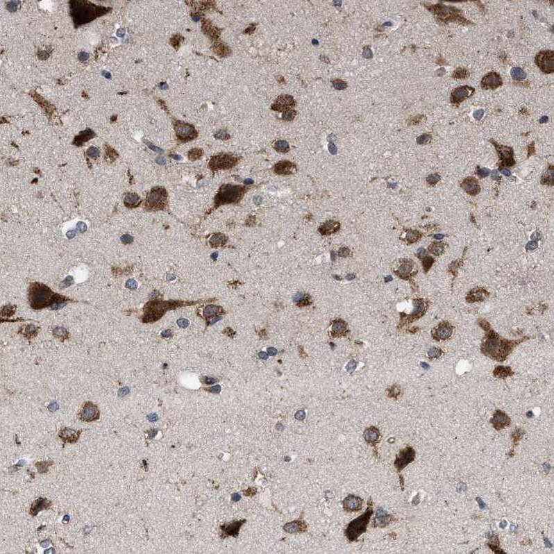 RENT1/UPF1/hUPF1 Antibody - BSA Free Immunohistochemistry-Paraffin: RENT1/UPF1/hUPF1 Antibody - BSA Free [NBP1-89641]