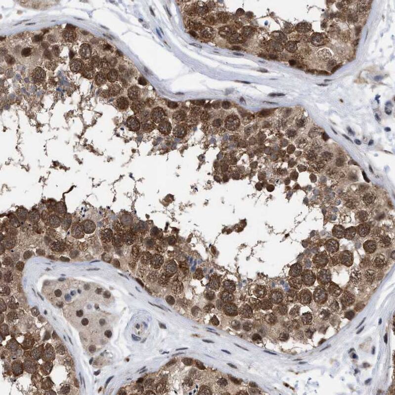 RENT1/UPF1/hUPF1 Antibody - BSA Free Immunohistochemistry-Paraffin: RENT1/UPF1/hUPF1 Antibody - BSA Free [NBP1-89641]
