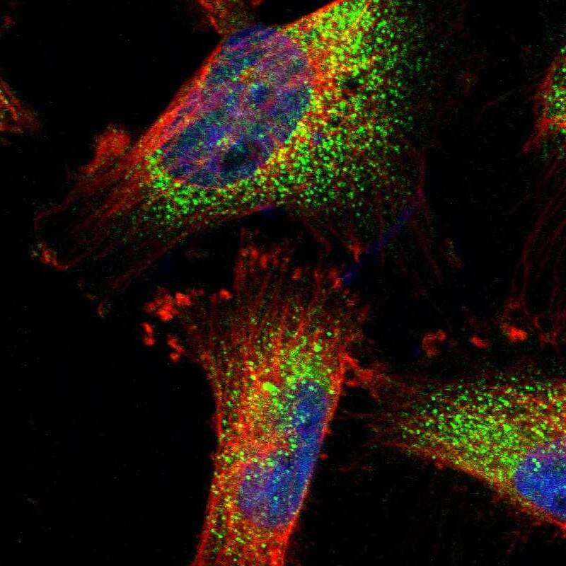 TRPC1 Antibody - BSA Free Immunocytochemistry/ Immunofluorescence: TRPC1 Antibody [NBP1-89648]