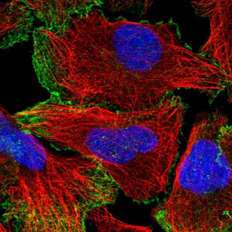 Neogenin Antibody - BSA Free Immunocytochemistry/ Immunofluorescence: Neogenin Antibody [NBP1-89651]