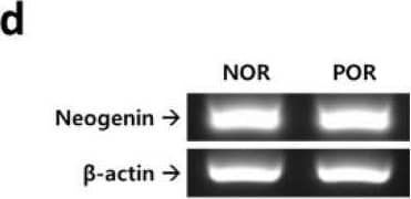 Neogenin Antibody - BSA Free