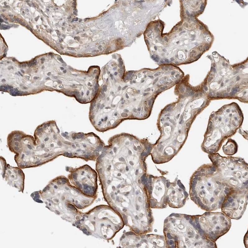MEK5 Antibody - BSA Free Immunohistochemistry-Paraffin: MEK5 Antibody - BSA Free [NBP1-89654]