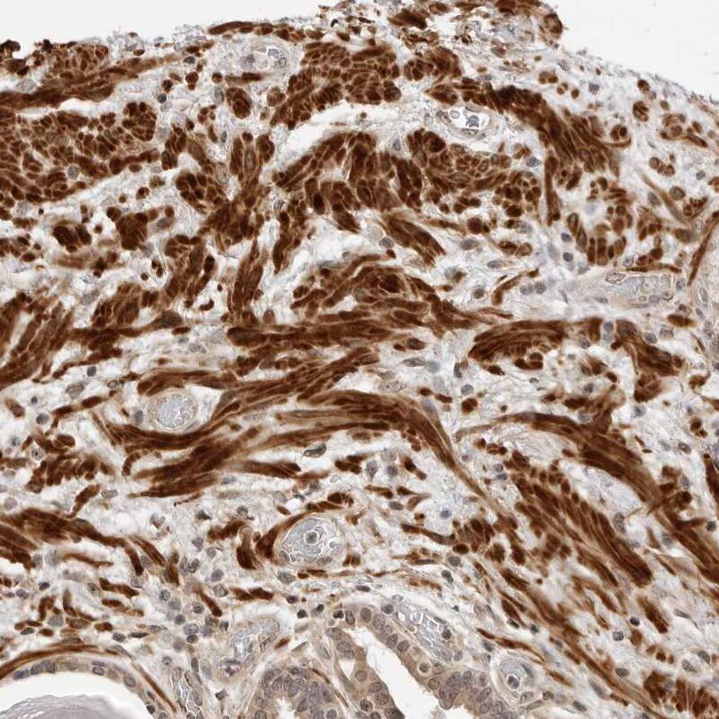 MEK5 Antibody - BSA Free Immunohistochemistry-Paraffin: MEK5 Antibody - BSA Free [NBP1-89654]