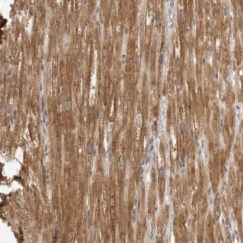MEK5 Antibody - BSA Free Immunohistochemistry-Paraffin: MEK5 Antibody - BSA Free [NBP1-89654]