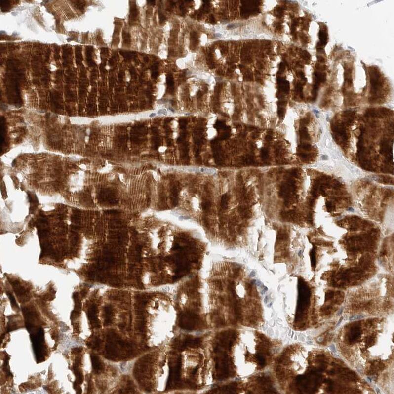 MEK5 Antibody - BSA Free Immunohistochemistry-Paraffin: MEK5 Antibody - BSA Free [NBP1-89654]