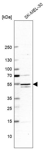 MEK5 Antibody - BSA Free Western Blot: MEK5 Antibody - BSA Free [NBP1-89654]