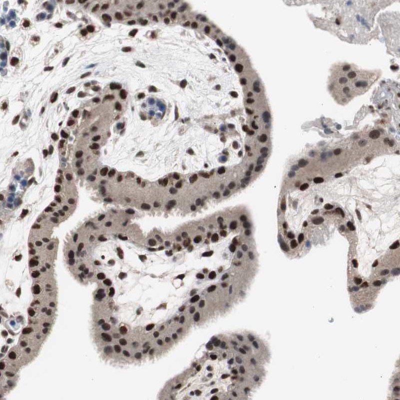 RPA70 Antibody - BSA Free Immunohistochemistry-Paraffin: RPA70 Antibody - BSA Free [NBP1-89658]