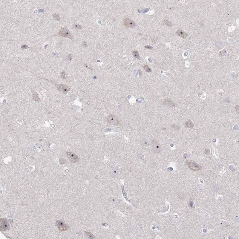 HSPC111 Antibody - BSA Free Immunohistochemistry-Paraffin: HSPC111 Antibody - BSA Free [NBP1-89659]