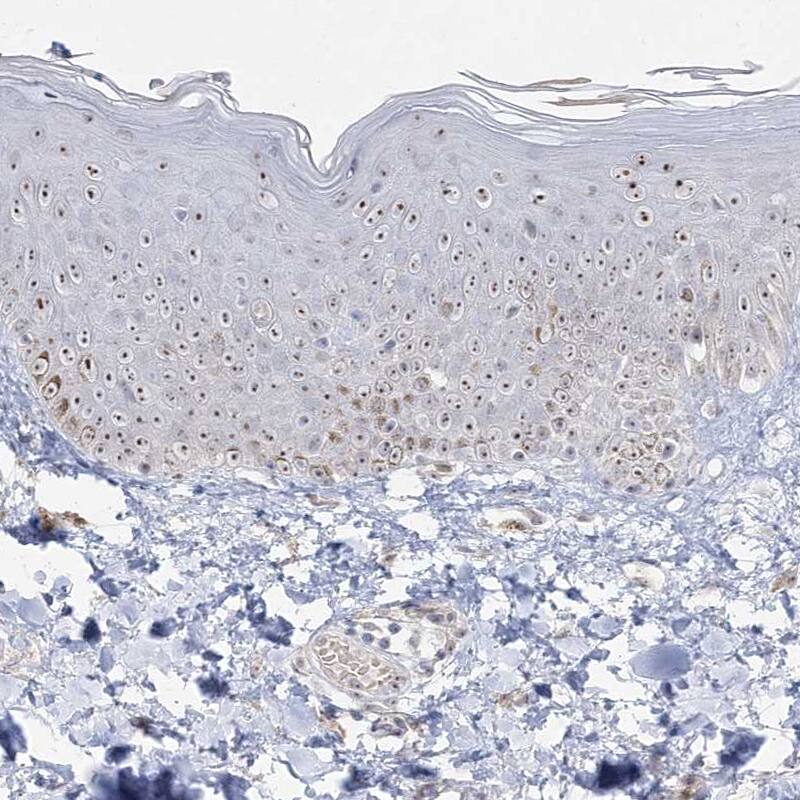 HSPC111 Antibody - BSA Free Immunohistochemistry-Paraffin: HSPC111 Antibody - BSA Free [NBP1-89659]