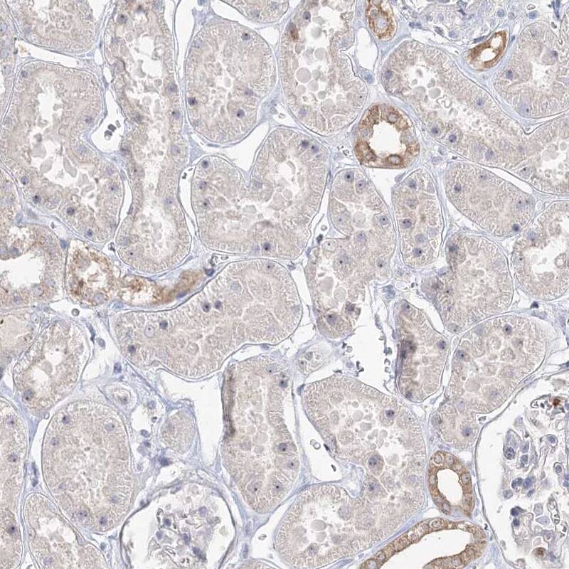 HSPC111 Antibody - BSA Free Immunohistochemistry-Paraffin: HSPC111 Antibody - BSA Free [NBP1-89659]