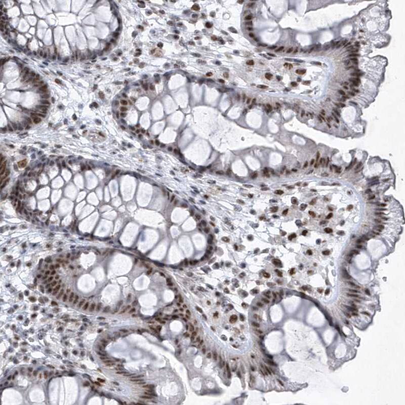 SNM1 Antibody - BSA Free Immunohistochemistry-Paraffin: SNM1 Antibody - BSA Free [NBP1-89663]