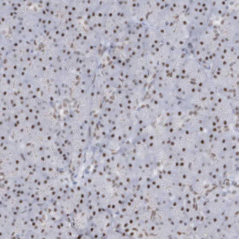 SNM1 Antibody - BSA Free Immunohistochemistry-Paraffin: SNM1 Antibody - BSA Free [NBP1-89663]