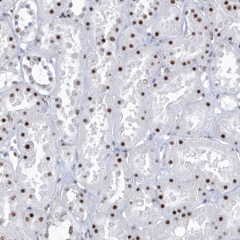 SNM1 Antibody - BSA Free Immunohistochemistry-Paraffin: SNM1 Antibody - BSA Free [NBP1-89663]