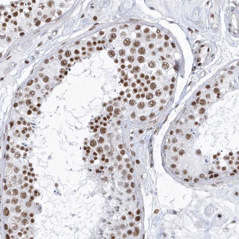 SNM1 Antibody - BSA Free Immunohistochemistry-Paraffin: SNM1 Antibody - BSA Free [NBP1-89663]