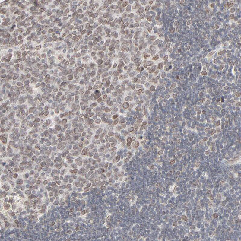 MAD1L1/MAD1 Antibody - BSA Free Immunohistochemistry-Paraffin: MAD1L1/MAD1 Antibody - BSA Free [NBP1-89664]