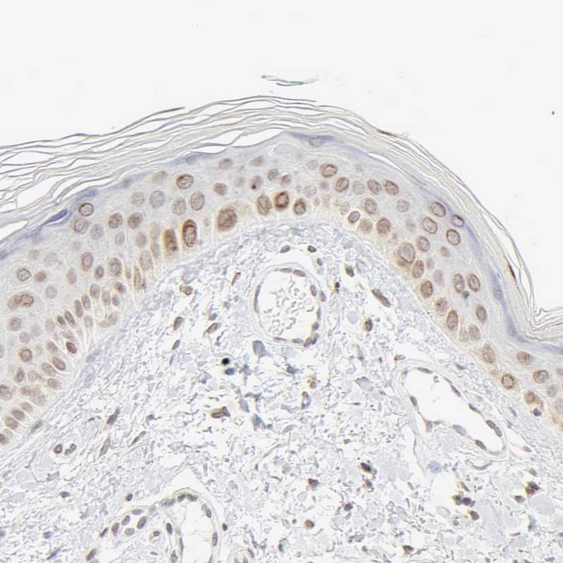 MAD1L1/MAD1 Antibody - BSA Free Immunohistochemistry-Paraffin: MAD1L1/MAD1 Antibody - BSA Free [NBP1-89664]