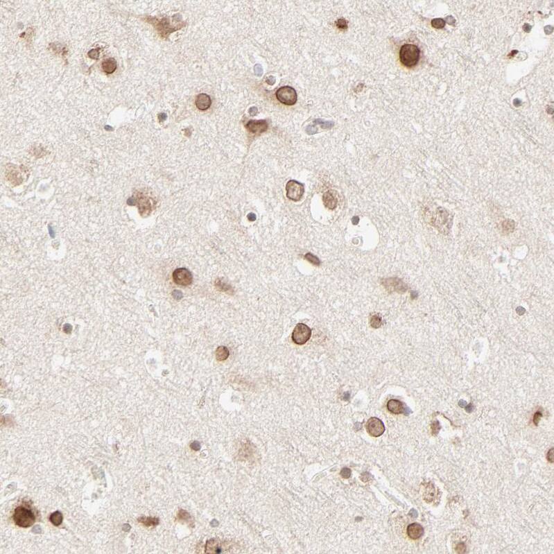 MAD1L1/MAD1 Antibody - BSA Free Immunohistochemistry-Paraffin: MAD1L1/MAD1 Antibody - BSA Free [NBP1-89664]